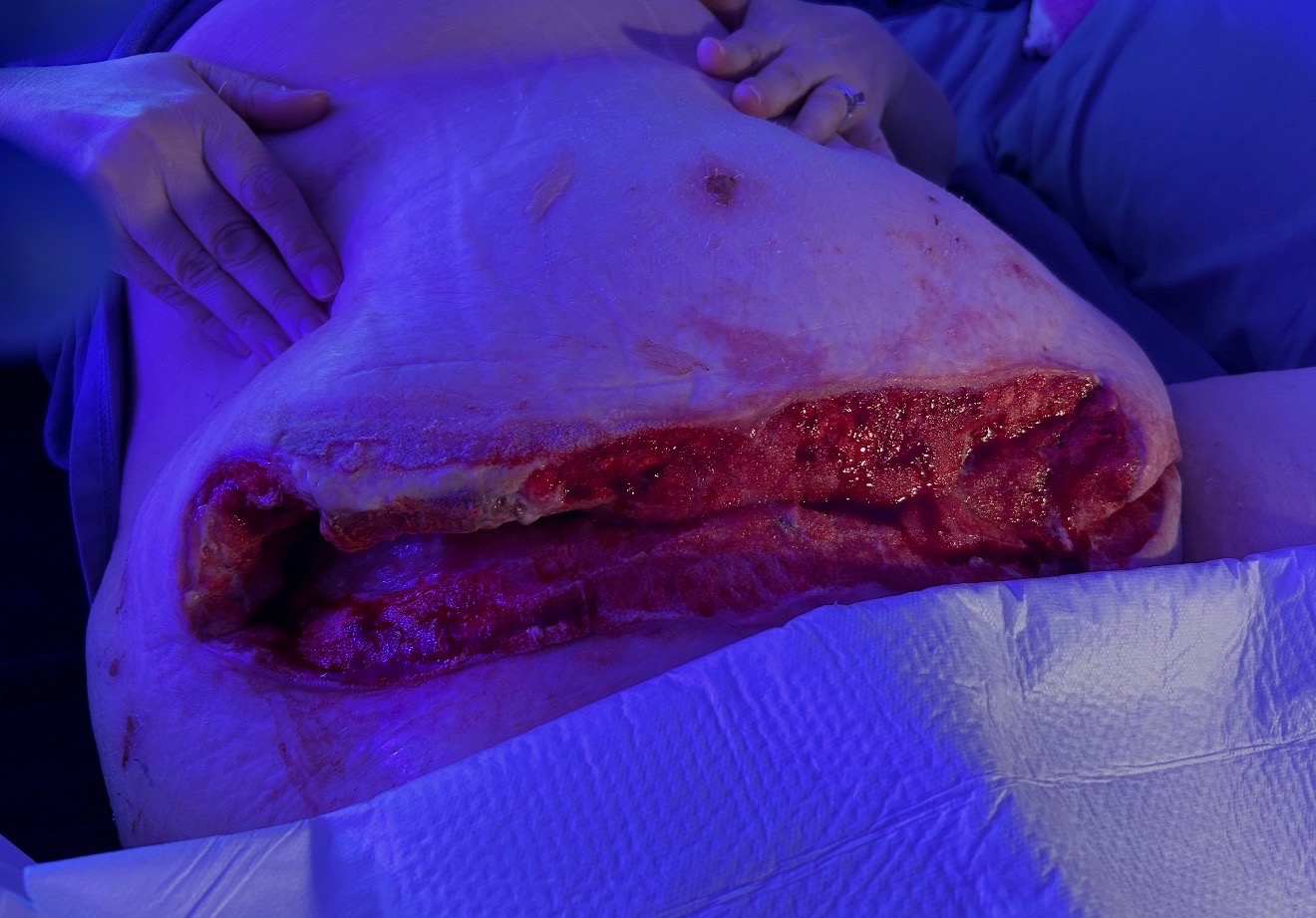 Before: Skin area affected by localized infection showing irritation and discoloration